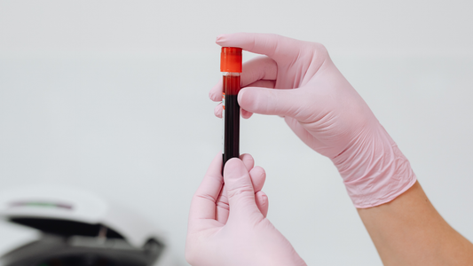 Why does my iron supplement cause nausea and constipation?
