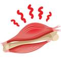 Muscle Cramps